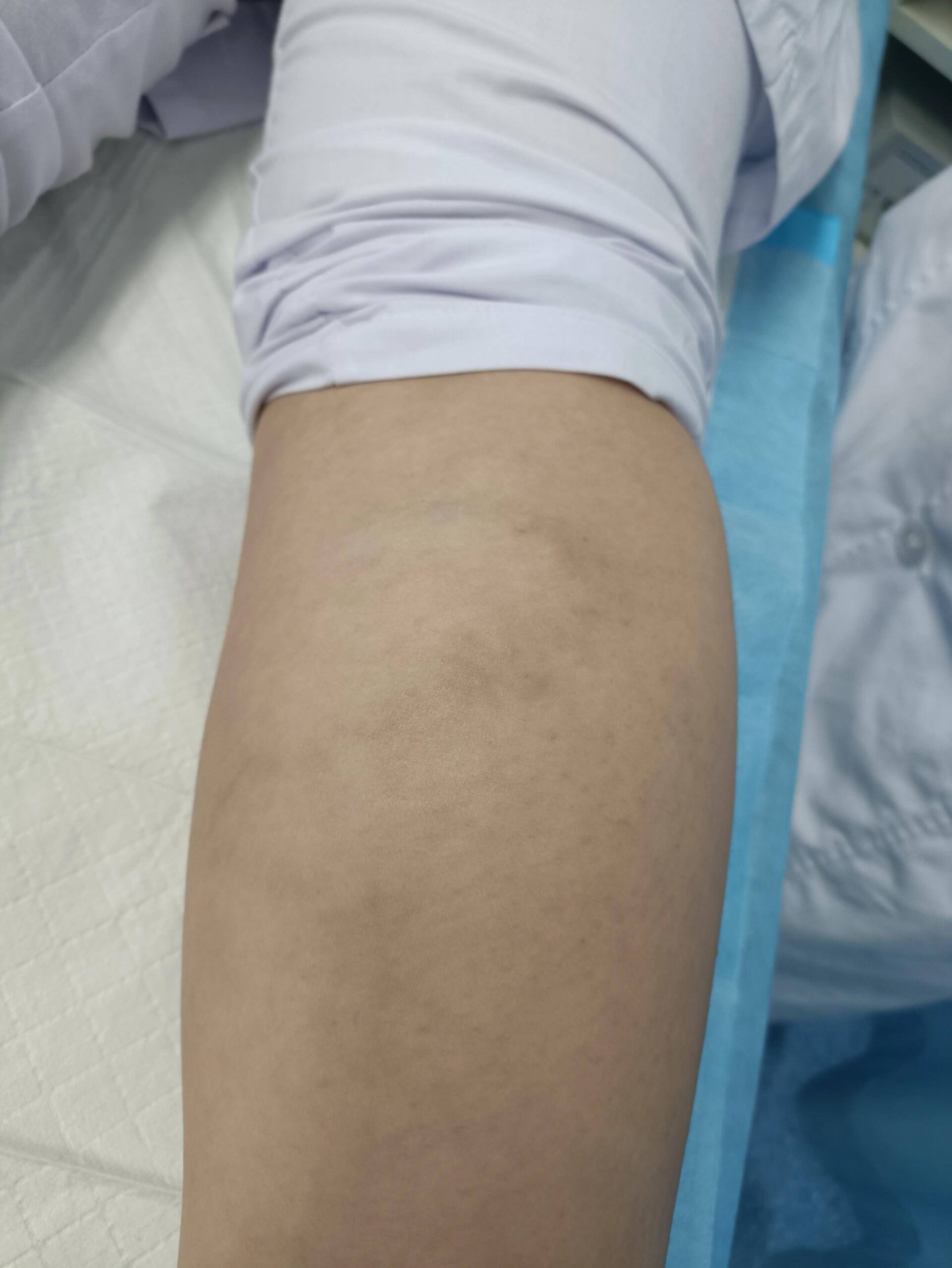 包含小腿伤病情况跟第六场时差不多不在乎外界是否尊重我们的词条